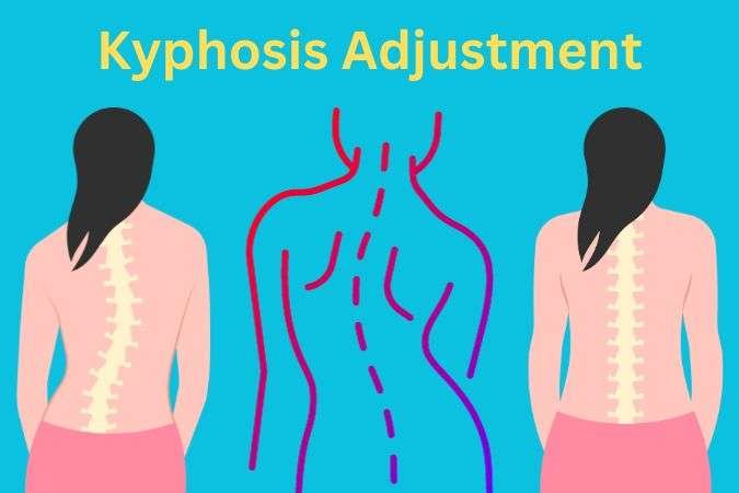 Can a Chiropractor Help with Kyphosis